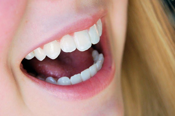 Răng sứ Cercon HT sự lựa chọn hàng đầu trong bọc răng sứ